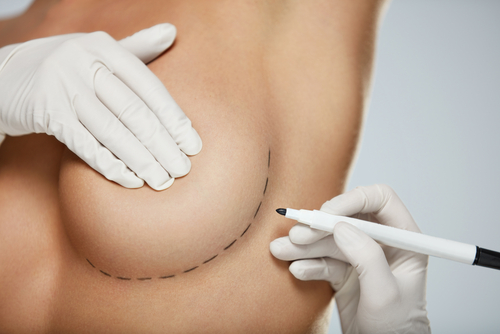 Do You Have Sagging Breasts After Losing Weight?